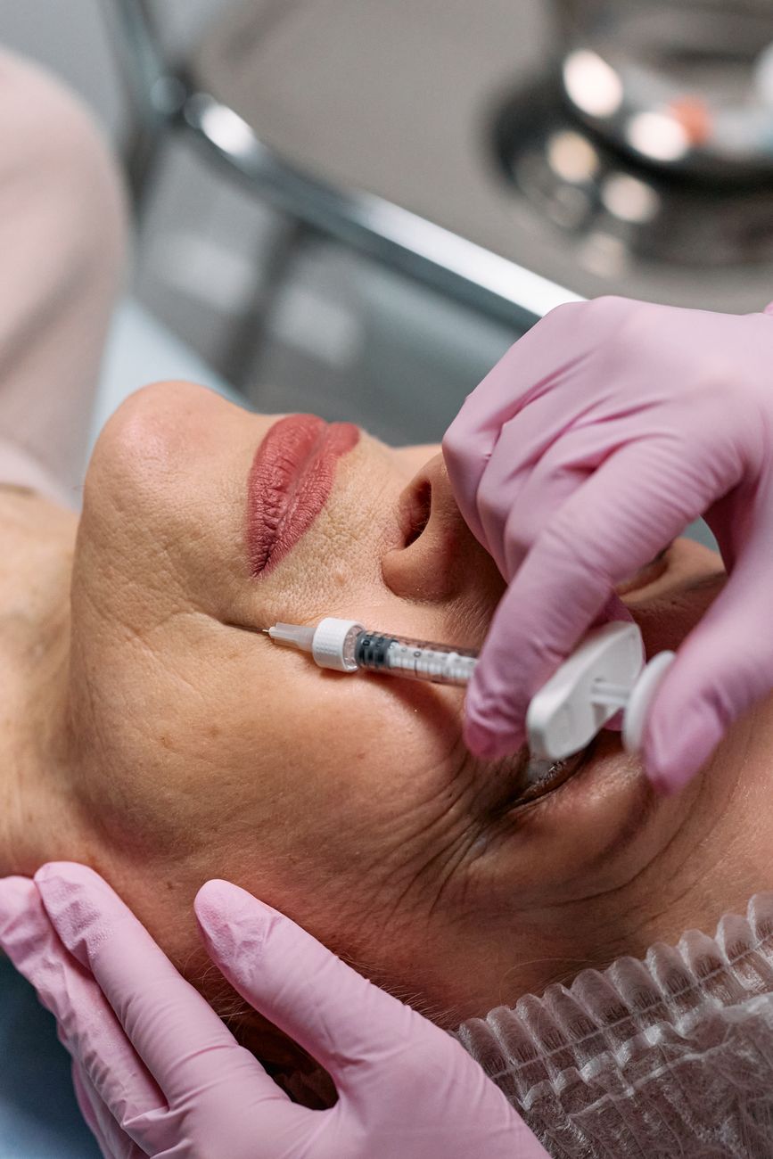 Aplicação de preenchimento facial com seringa, em detalhe